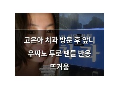 고은아 치과 방문 후 앞니 우짜노 투로 팬들 반응 뜨거움
